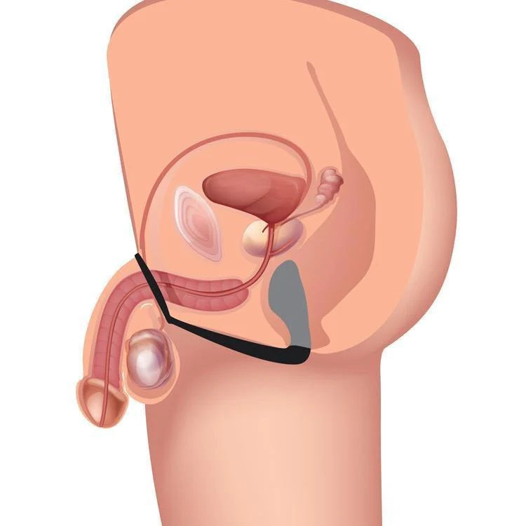 Plug Anal Estimula Prostata Plug Slim Y Anillo Anal Adventures Platinum - Cock Ring Plug - Black